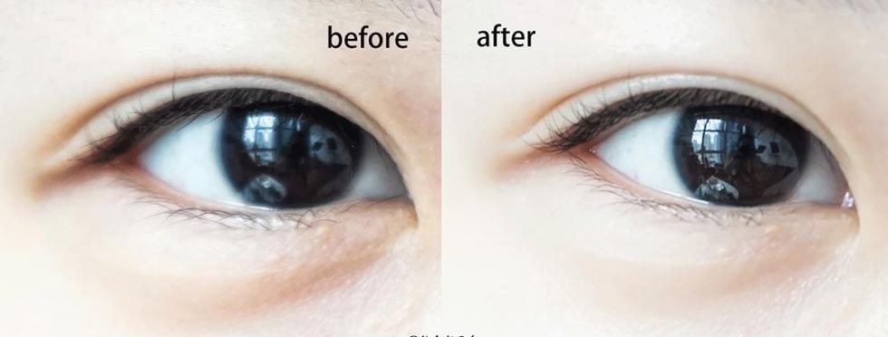 Natural Eye Bag Repair Essence